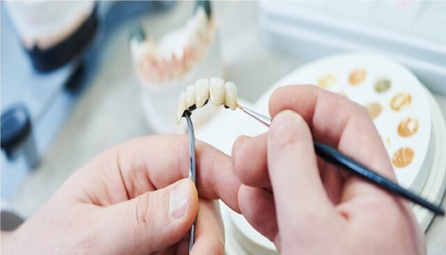 اعطای مجوز دانش‌بنیان برای 6 محصول حوزه دندانپزشکی